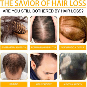 OUHOE - Biotin Hair Growth Serum